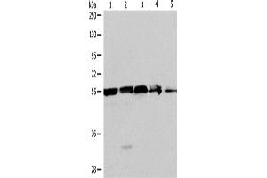 Western Blotting (WB) image for anti-Nicotinamide phosphoribosyltransferase (NAMPT) antibody (ABIN2428901) (NAMPT Antikörper)