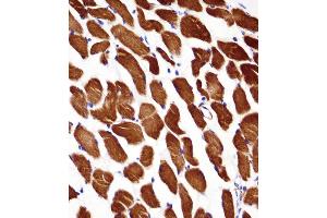 ACTA1/alpha -actin Antibody immunohistochemistry analysis in formalin fixed and paraffin embedded human skeletal muscle followed by peroxidase conjugation of the secondary antibody and DAB staining. (Actin Antikörper  (C-Term))