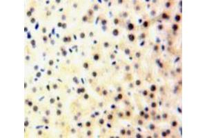 Used in DAB staining on fromalin fixed paraffin-embedded Liver tissue (A2BP1 Antikörper  (AA 149-399))