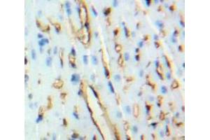 Used in DAB staining on fromalin fixed paraffin-embedded Heart tissue (BNP Antikörper  (AA 77-121))