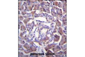 PRSS3 Antibody immunohistochemistry analysis in formalin fixed and paraffin embedded human pancreas tissue followed by peroxidase conjugation of the secondary antibody and DAB staining.