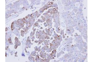 IHC-P Image Immunohistochemical analysis of paraffin-embedded OVCAR3 xenograft, using ERP29, antibody at 1:500 dilution. (ERP29 Antikörper)