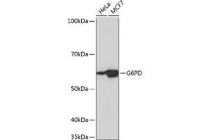 Western blot analysis of extracts of various cell lines, using G6PD Rabbit mAb (ABIN7267402) at 1:1000 dilution. (Glucose-6-Phosphate Dehydrogenase Antikörper)