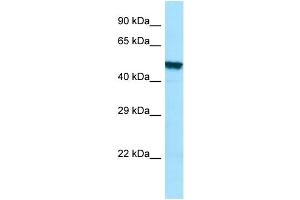 WB Suggested Anti-PLA2G3 Antibody Titration: 1. (PLA2G3 Antikörper  (C-Term))