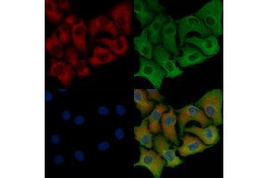 ABIN6258423 and ABIN6276238 staining Hela cells by IF/ICC. (GIPR Antikörper  (Internal Region))