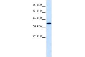 Western Blotting (WB) image for anti-Zinc Finger Protein 75 (ZNF75) antibody (ABIN2461224)