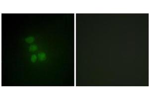 Immunofluorescence analysis of HepG2 cells, using hnRNP G antibody. (RBMX Antikörper  (N-Term))