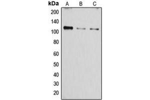 Western blot analysis of SERCA1 expression in A549 (A), mouse muscle (B), rat muscle (C) whole cell lysates. (ATP2A1/SERCA1 Antikörper  (Center))