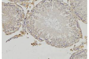 ABIN6273477 at 1/100 staining RAT testis tissue by IHC-P.