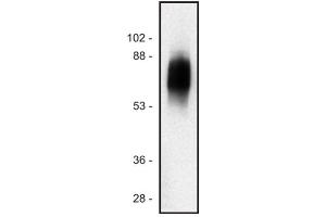 Western blot of human Jurkat T cell line (SIT1 Antikörper)