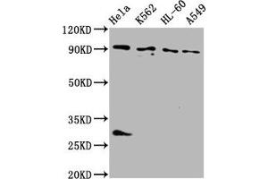 Western Blot Positive WB detected in: Hela whole cell lysate, K562 whole cell lysate, HL60 whole cell lysate, A549 whole cell lysate All lanes: BICD2 antibody at 4 μg/mL Secondary Goat polyclonal to rabbit IgG at 1/50000 dilution Predicted band size: 94, 97 kDa Observed band size: 94 kDa (BICD2 Antikörper  (AA 511-625))