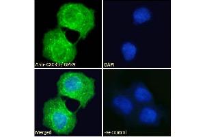 ABIN334381 Immunofluorescence analysis of paraformaldehyde fixed A431 cells, permeabilized with 0. (CXCR3 Antikörper  (C-Term))