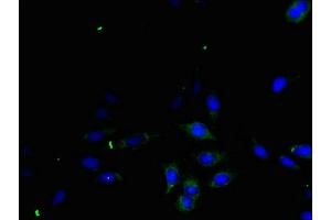 Immunofluorescent analysis of Hela cells using ABIN7166593 at dilution of 1:100 and Alexa Fluor 488-congugated AffiniPure Goat Anti-Rabbit IgG(H+L) (TGFA Antikörper  (AA 40-89))