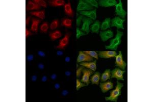 ABIN6255025 and ABIN6266462 staining Hela cells(heat shock treatment) by IF/ICC. (RIPK2 Antikörper  (pSer176))