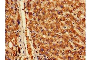 Immunohistochemistry of paraffin-embedded human liver tissue using ABIN7142170 at dilution of 1:100 (OAS1 Antikörper  (AA 296-395))