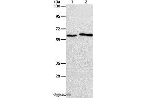 Western blot analysis of A172 and A549 cell, using CHRNA2 Polyclonal Antibody at dilution of 1:950 (CHRNA2 Antikörper)