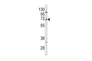 Western blot analysis of PCSK9 Antibody (N-term) (ABIN652320 and ABIN2841467) in Jurkat cell line lysates (35 μg/lane).