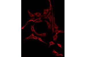 ABIN6275770 staining HepG2 by IF/ICC. (IL13RA2 Antikörper  (C-Term))