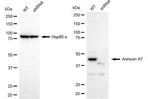 Western blotting analysis using Annexin A7 antibody (ABIN7797626). (Rekombinanter Annexin VII Antikörper)