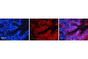Rabbit Anti-NFKB2 Antibody   Formalin Fixed Paraffin Embedded Tissue: Human Appendix (Colon) Tissue Observed Staining: Cytoplasm Primary Antibody Concentration: 1:100 Other Working Concentrations: 1:600 Secondary Antibody: Donkey anti-Rabbit-Cy3 Secondary Antibody Concentration: 1:200 Magnification: 20X Exposure Time: 0. (NFKB2 Antikörper  (N-Term))