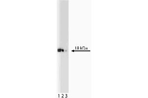 Western blot analysis of eIF-5a on a Jurkat lysate.