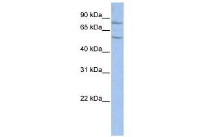 WB Suggested Anti-TCTE1 Antibody Titration: 0. (TCTE1 Antikörper  (Middle Region))