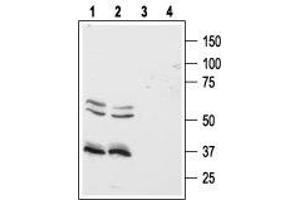 HCRTR1 Antikörper  (3rd Intracellular Loop)