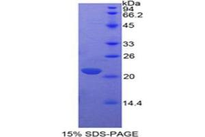 SDS-PAGE (SDS) image for Interleukin 17 (IL17) (AA 1-155) protein (His tag) (ABIN1879031)