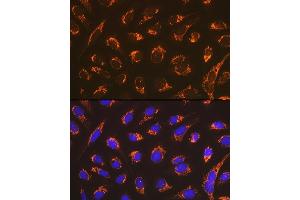 Immunofluorescence analysis of U-2 OS cells using Smac/Diablo Rabbit mAb (ABIN7270177) at dilution of 1:100 (40x lens). (DIABLO Antikörper)