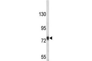 Western Blotting (WB) image for anti-Amyloid beta (A4) Precursor Protein (APP) (AA 735-763) antibody (ABIN3029685)
