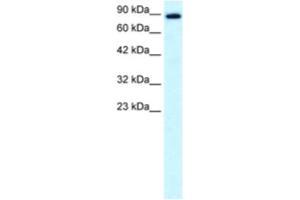 Western Blotting (WB) image for anti-Kinesin Family Member 21A (KIF21A) antibody (ABIN2460843) (KIF21A Antikörper)