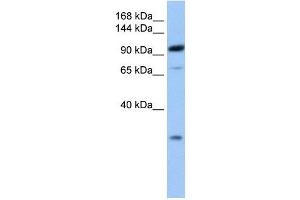 AP2B1 antibody used at 1 ug/ml to detect target protein. (AP2B1 Antikörper  (C-Term))