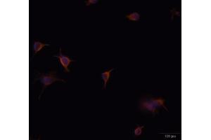 Immunofluorescence analysis of U-251 MG cells using GFAP antibody (ABIN5970067). (GFAP Antikörper)