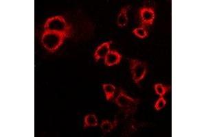 Immunofluorescent analysis of IFNGR1 staining in HepG2 cells. (IFNGR1 Antikörper  (C-Term))