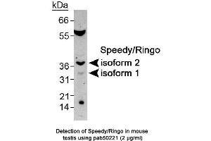Speedy Homolog B (Xenopus Laevis) (SPDYB) (AA 200-286), (both Isoforms), (C-Term) Antikörper