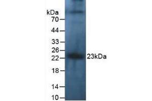 Figure. (IL-10 Antikörper  (AA 1-178))