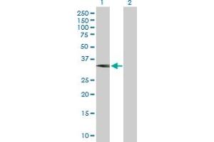 Western Blot analysis of WBSCR22 expression in transfected 293T cell line by WBSCR22 MaxPab polyclonal antibody. (WBSCR22 Antikörper  (AA 1-281))