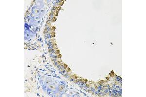 Immunohistochemistry of paraffin-embedded mouse lung using AIF1 antibody (ABIN5970719) at dilution of 1/100 (40x lens). (Iba1 Antikörper)