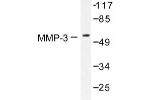 Image no. 1 for anti-Matrix Metallopeptidase 3 (Stromelysin 1, Progelatinase) (MMP3) antibody (ABIN265531) (MMP3 Antikörper)