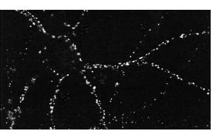 Immunocytochemistry/Immunofluorescence analysis using Mouse Anti-PSD95 Monoclonal Antibody, Clone 6G6 . (DLG4 Antikörper  (Atto 594))
