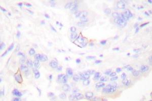 Image no. 1 for anti-V-Crk Sarcoma Virus CT10 Oncogene Homolog (Avian) (CRK) antibody (ABIN265373) (Crk Antikörper)