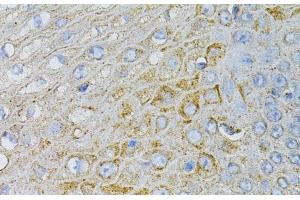 Immunohistochemistry of paraffin-embedded Human esophagus using NPC2 Polyclonal Antibody at dilution of 1:100 (40x lens).