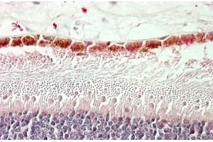 (ABIN571175) (5 μg/mL) staining of paraffin embedded Human Retina. (RDH5 Antikörper  (AA 19-31))