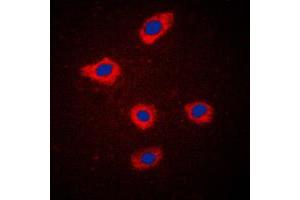 Immunofluorescent analysis of Mammaglobin A staining in MCF7 cells.