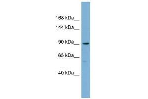 Western Blot showing E2F8 antibody used at a concentration of 1-2 ug/ml to detect its target protein. (E2F8 Antikörper  (Middle Region))