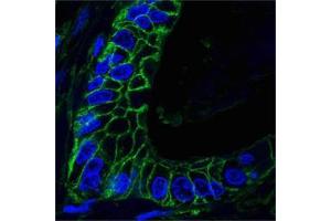 Confocal analysis of paraffin-embedded human lung cancer tissues using CD44 antibody (green), showing membrane localization. (CD44 Antikörper)