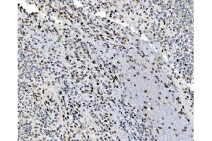 IHC analysis of JUNB using anti-JUNB antibody (ABIN7603223). (JunB Antikörper  (N-Term))