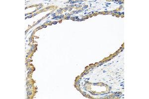 Immunohistochemistry of paraffin-embedded human prostate using NYX antibody at dilution of 1:100 (40x lens).