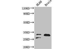 Western Blot Positive WB detected in: HL60 whole cell lysate, Mouse brain tissue All lanes: TPI1 antibody at 2 μg/mL Secondary Goat polyclonal to rabbit IgG at 1/50000 dilution Predicted band size: 31, 27, 18 kDa Observed band size: 31, 27 kDa (TPI1 Antikörper  (AA 169-228))
