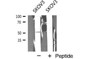Western blot analysis of Cyclin A1 expression in SKOV3 cell extract (Cyclin A1 Antikörper)